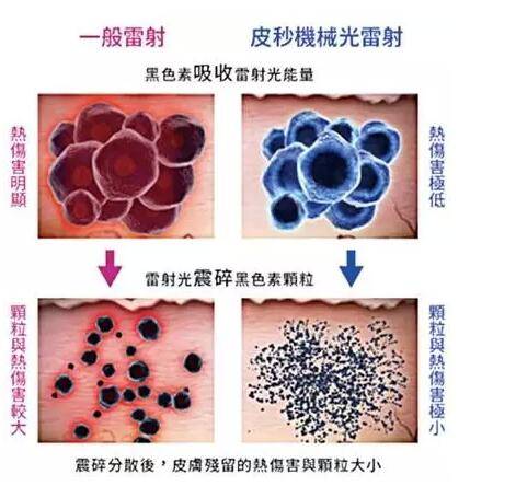 最新皮秒激光手艺，刷新与应用远景展望